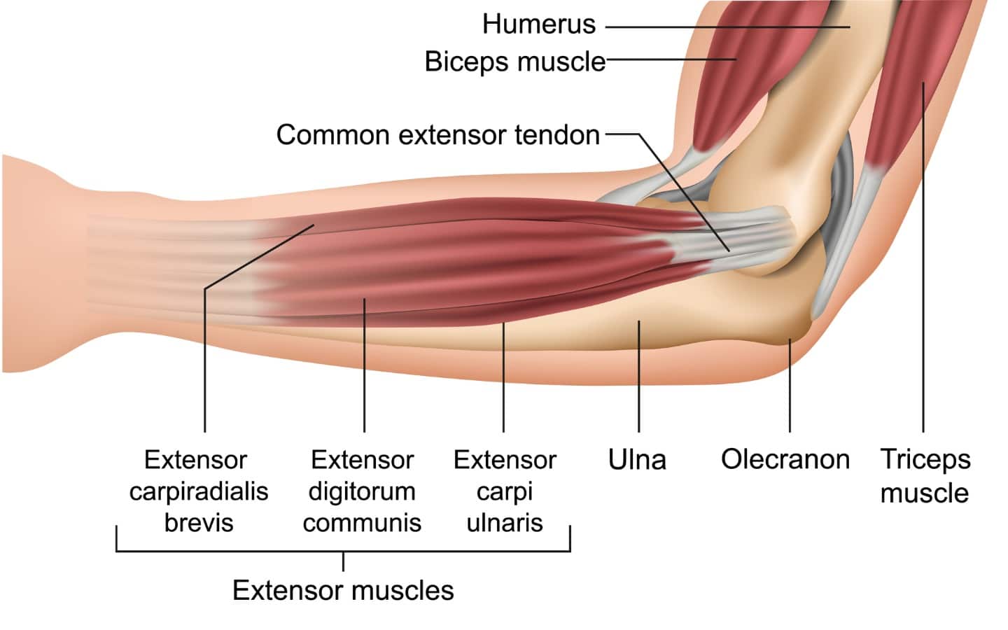 Anatomy Corner: Tennis Elbow
